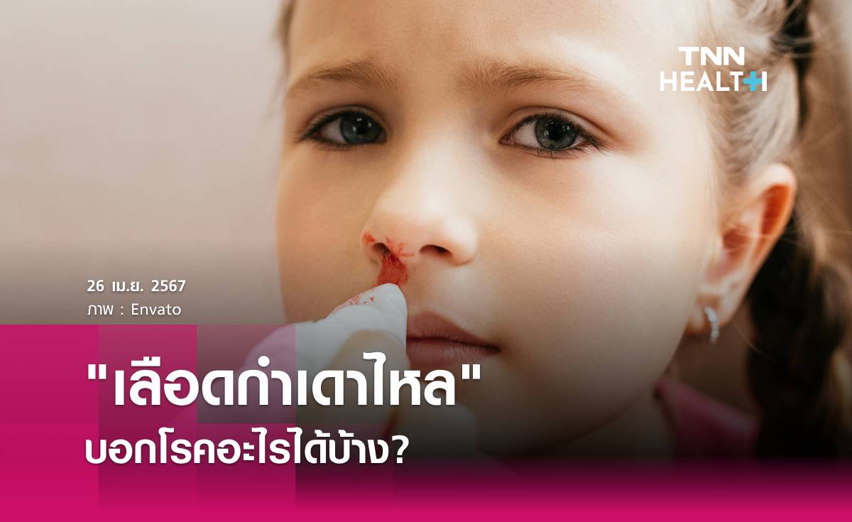 "เลือดกำเดาไหล" สัญญาณเตือนการเกิดโรคอะไรได้บ้าง เช็กเลย!