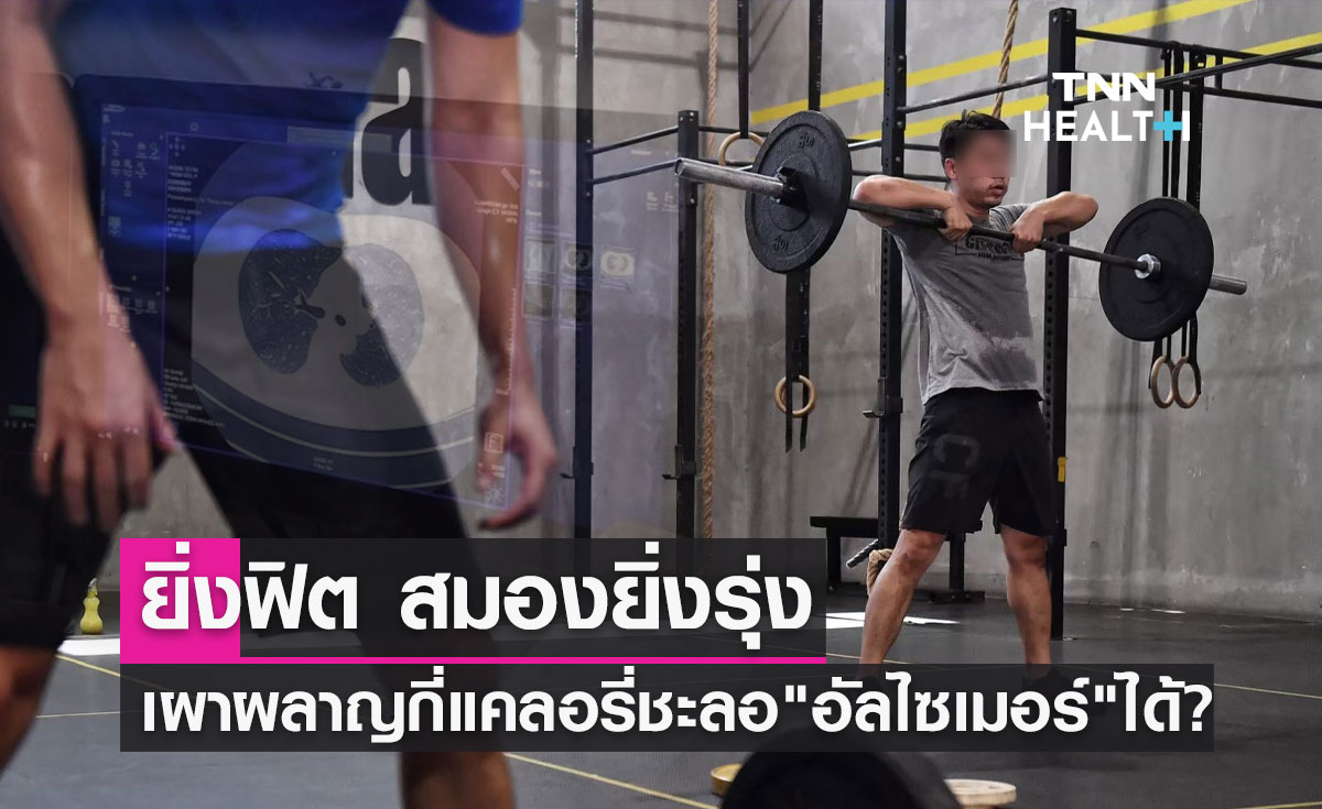 อัลไซเมอร์ แนะวิธีออกกำลังกาย เผาผลาญกี่แคลอรี่ให้ผลดีชะลอโรคได้?