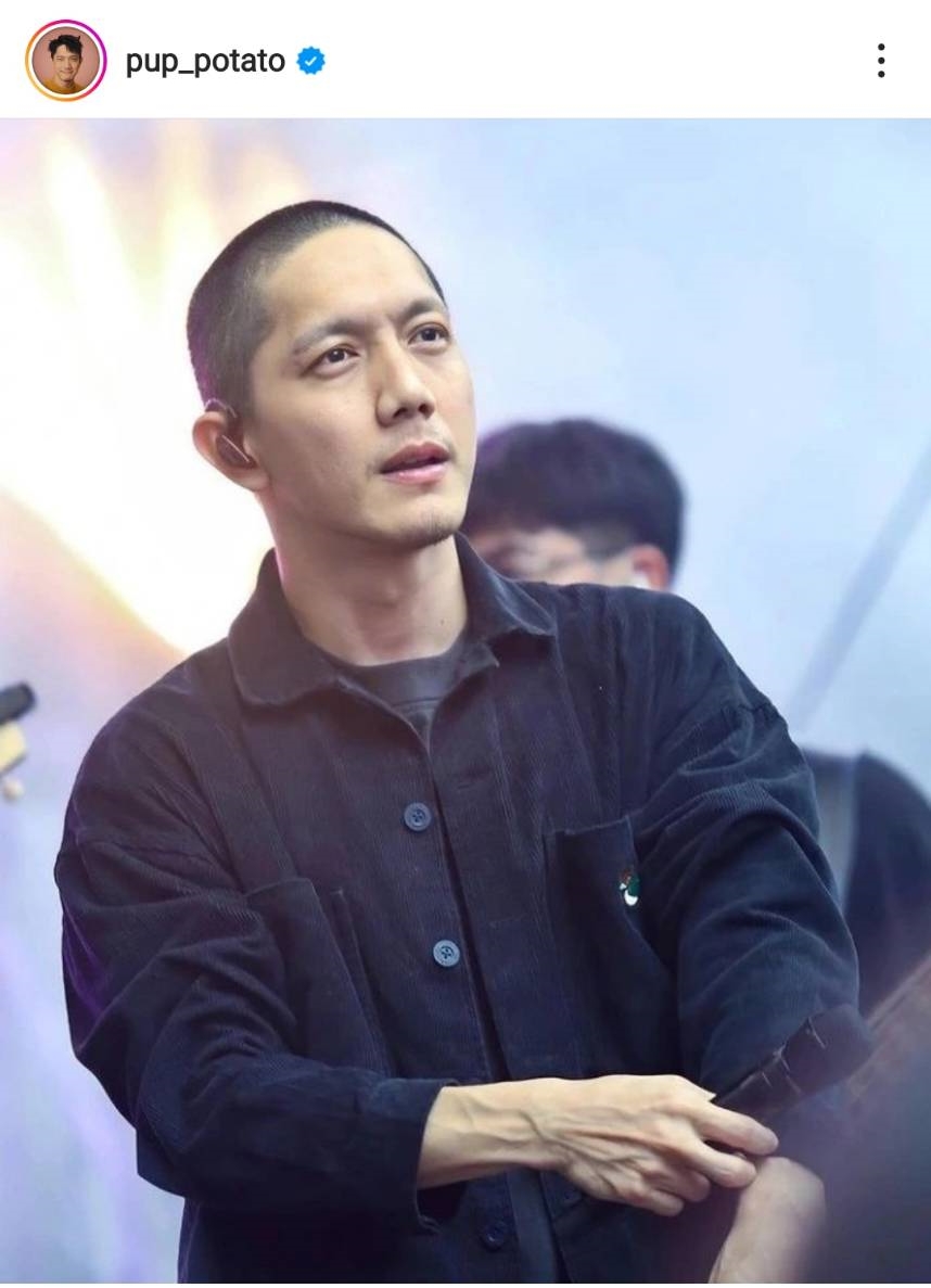 ปั๊บ โปเตโต้ แชร์ประสบการณ์ ก้างติดคอ ต้องล้วงคอลึกมาก
