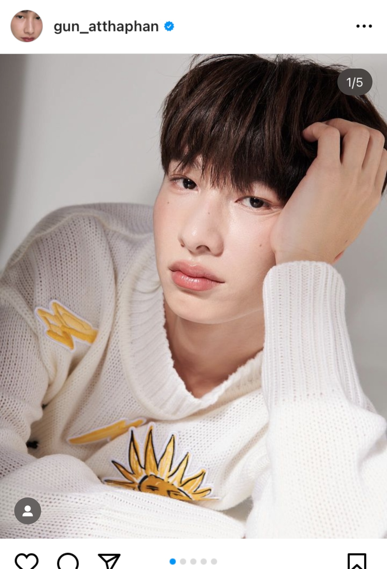 กัน อรรถพันธ์ ป่วยตาแดง ด้านแฟนคลับแห่ให้กำลังใจ  