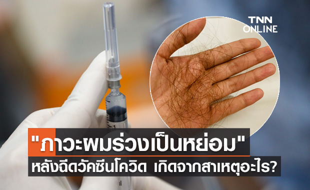 "ภาวะผมร่วงเป็นหย่อม" หลังฉีดวัคซีนโควิด-19 เกิดจากสาเหตุอะไร?