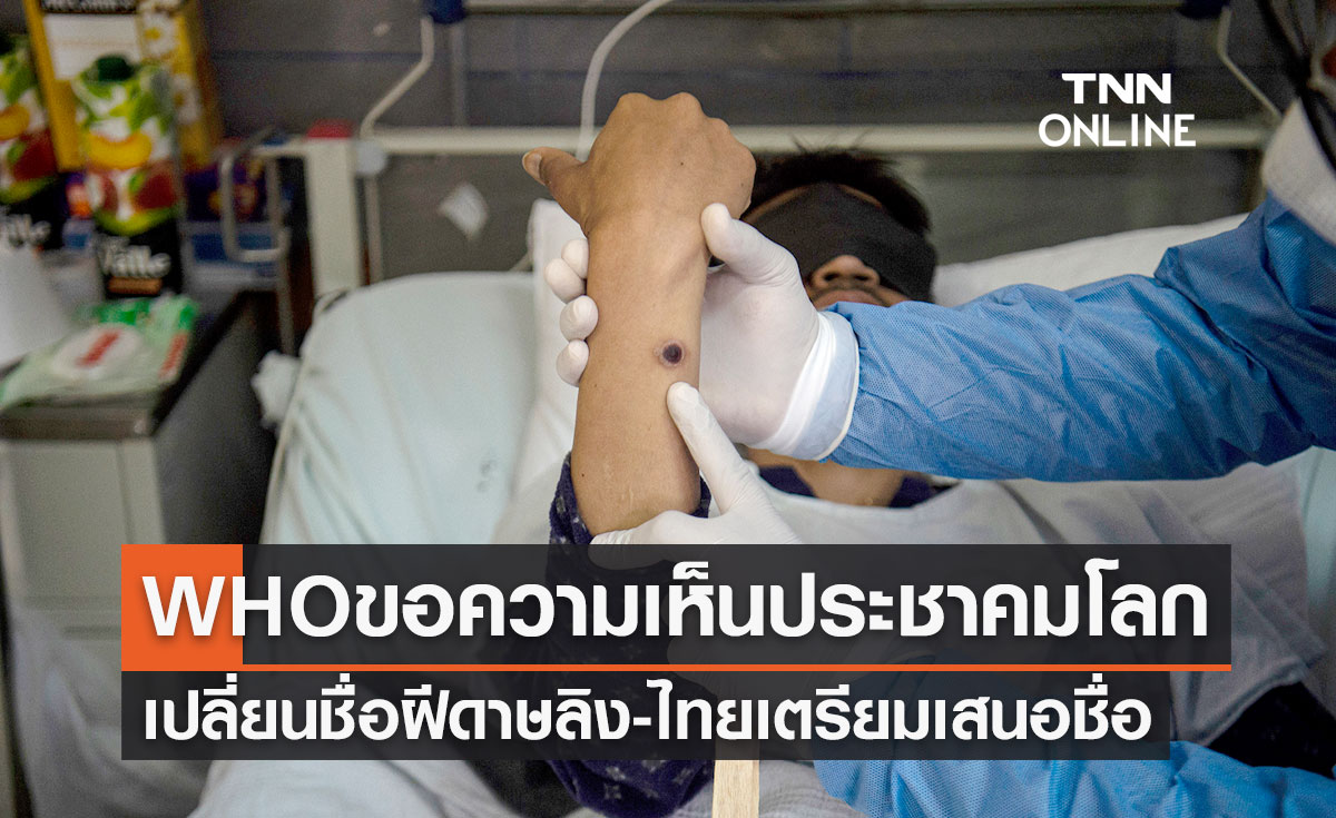 องค์การอนามัยโลก ขอความเห็นเปลี่ยนชื่อ "ฝีดาษลิง" ลดตีตรา ไทยเตรียมเสนอชื่อ