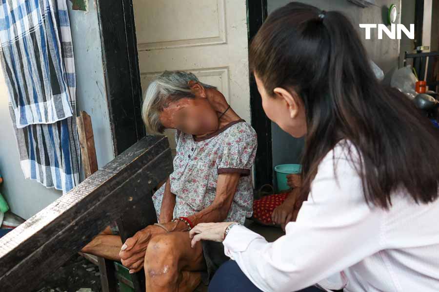 ลงพื้นที่เยี่ยม ‘ป้าน้อย’ หญิงชราร่างกายผิดรูป พม. เร่งช่วยเหลือให้ได้รับเบี้ยคนพิการ ลงพื้นที่เยี่ยม ‘ป้าน้อย’ หญิงชราร่างกายผิดรูป พม. เร่งช่วยเหลือให้ได้รับเบี้ยคนพิการ