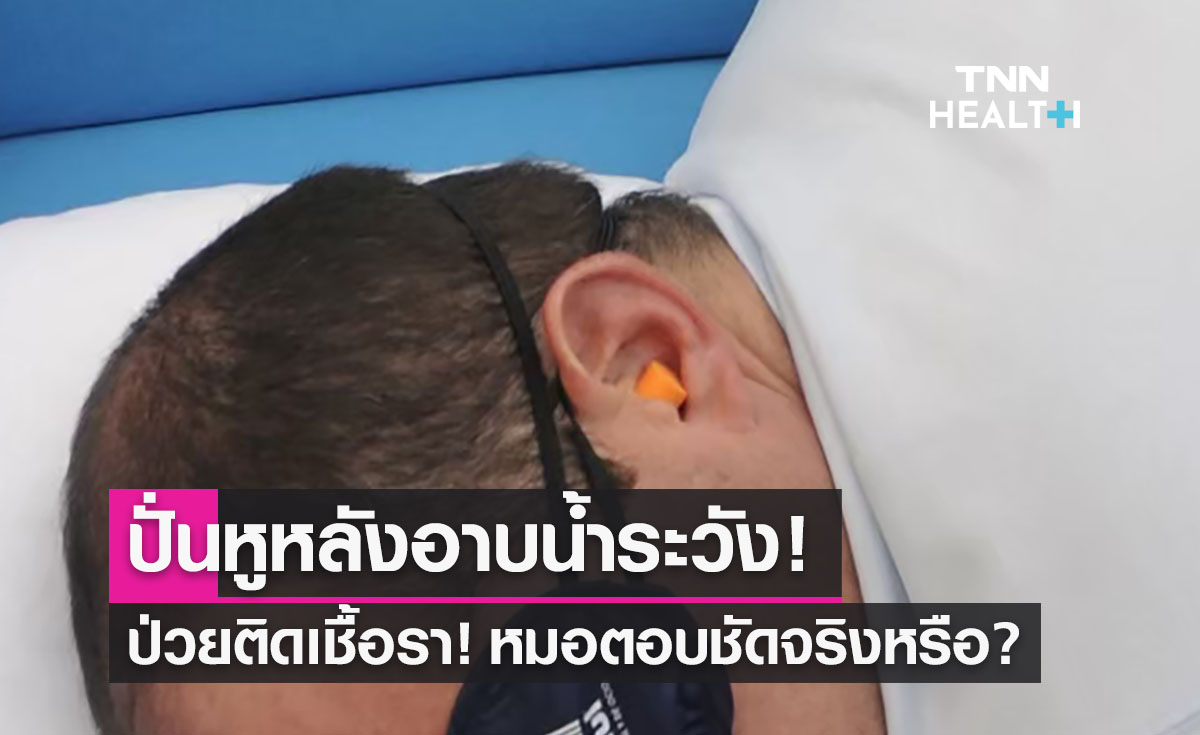 ปั่นหูหลังอาบน้ำระวัง!เป็นเชื้อรา หมอตอบชัดจริงหรือ? 