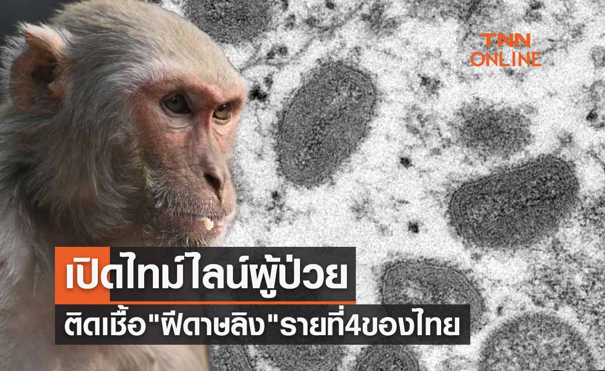 เปิดไทม์ไลน์ หญิงไทยป่วย ฝีดาษลิง รายที่ 4 มีประวัติเสี่ยงใกล้ชิดชายชาวต่างชาติ