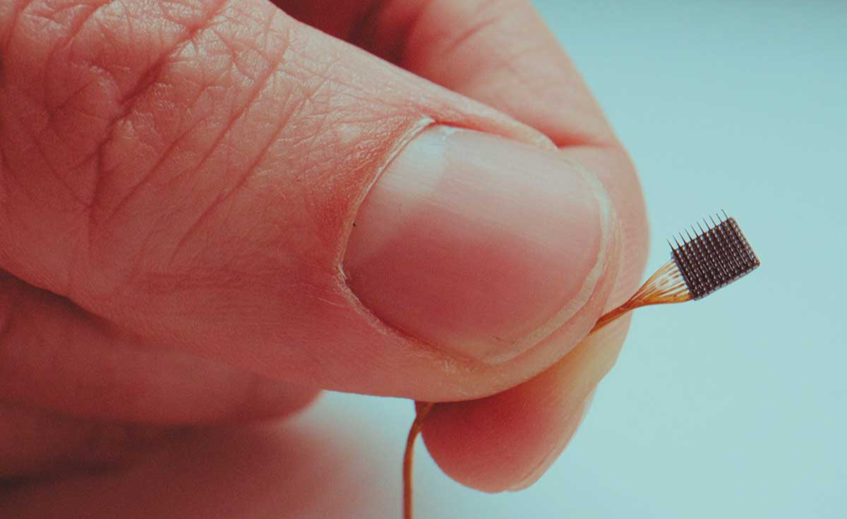 Neuralink โดนแซงหน้า คู่แข่งทดลองฝังชิปในสมองมนุษย์แล้ว 50 ราย