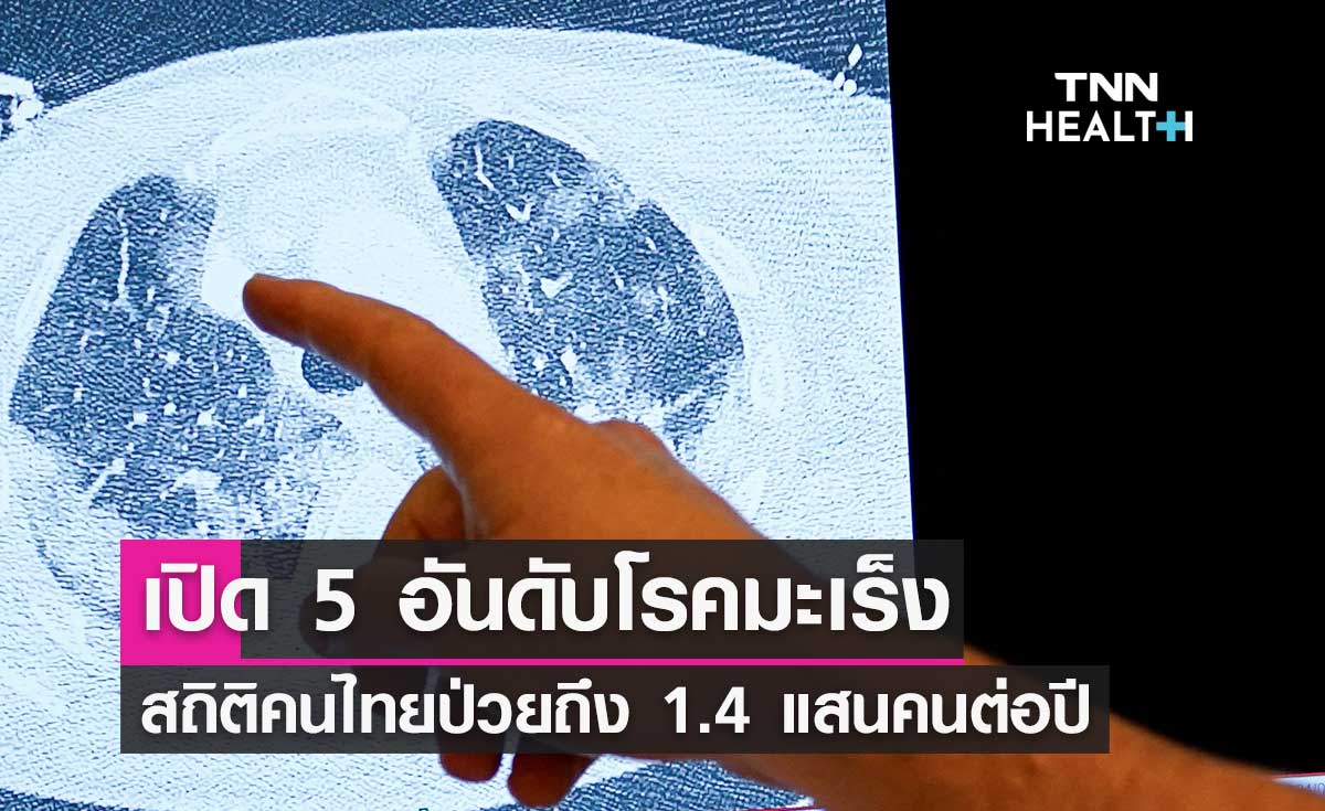 5 อันดับโรคมะเร็งพบมากในคนไทย เปิดสถิติป่วยรายใหม่ถึง 1.4 แสนคนต่อปี