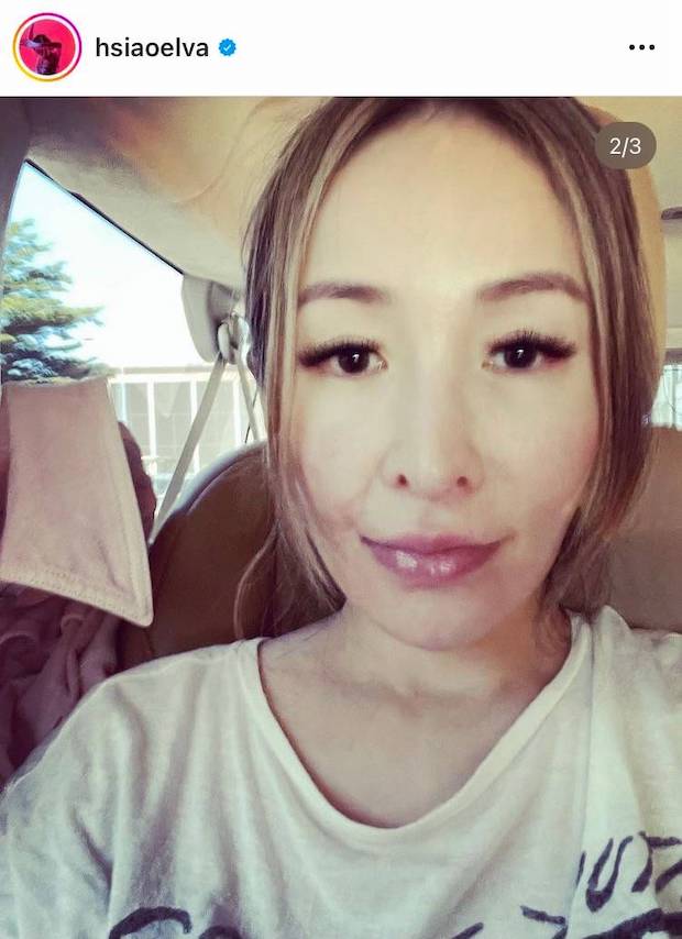 เผยหน้าสด!! ‘เอลวา เซียว’ หลังถูกสุนัขกัดที่ใบหน้ากว่า 1 ปี (มีคลิป)