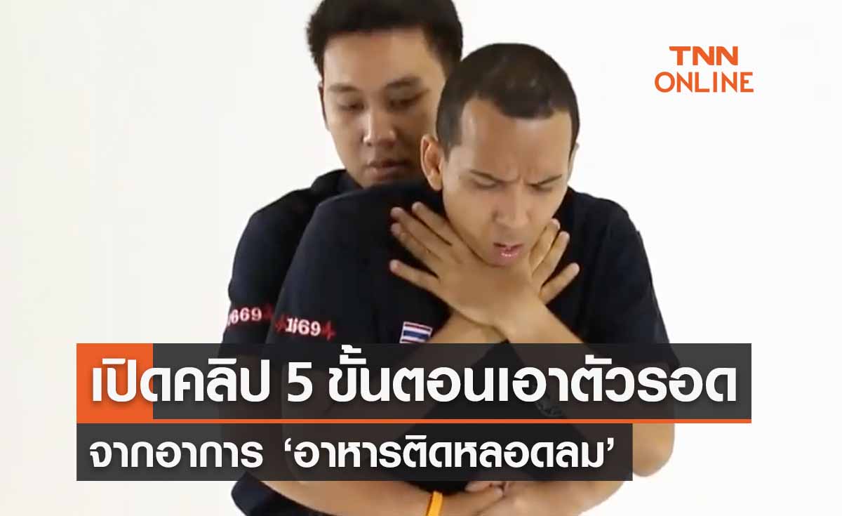 อาหารติดหลอดลม เปิดคลิป 5 ขั้นตอนเอาตัวรอดลดความเสี่ยงเสียชีวิต 