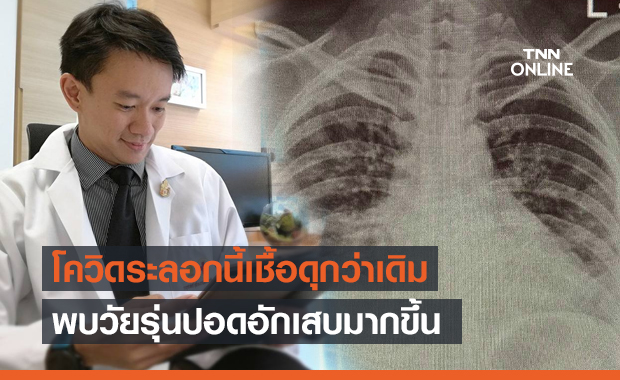 "หมอจุฬาฯ" ชี้โควิดระลอกนี้เชื้อดุกว่าเดิม จะเห็นเคสหนักในไอซียูมากขึ้น