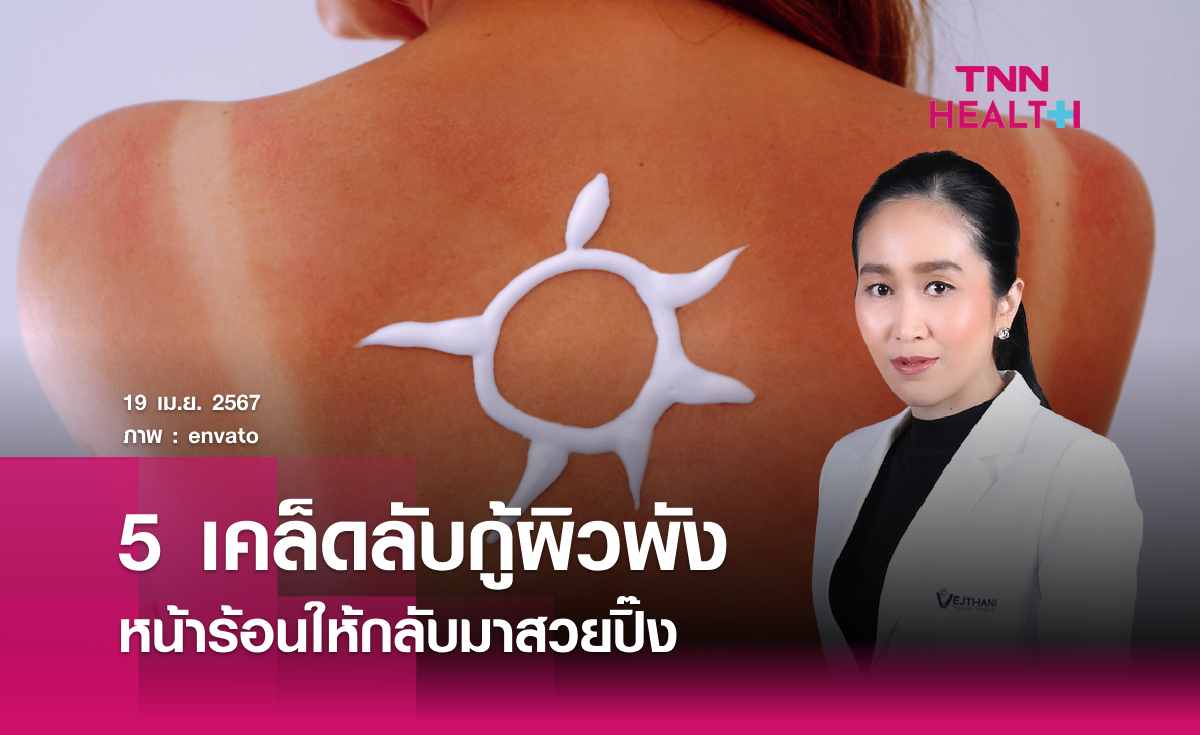 5 เคล็ดลับกู้ผิวพังหน้าร้อนให้กลับมาสวยปิ๊ง