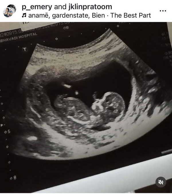 แพร เอมเมอรี่ ว่าที่คุณแม่! โพสต์แจ้งข่าวดีกำลังตั้งท้องลูกคนแรก
