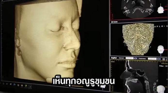 ใหม่ ดาวิกา ตอบกลับแซ่บ หลังชาวเน็ตคอมเมนต์ไม่เชื่อว่าไม่ได้ศัลยกรรม