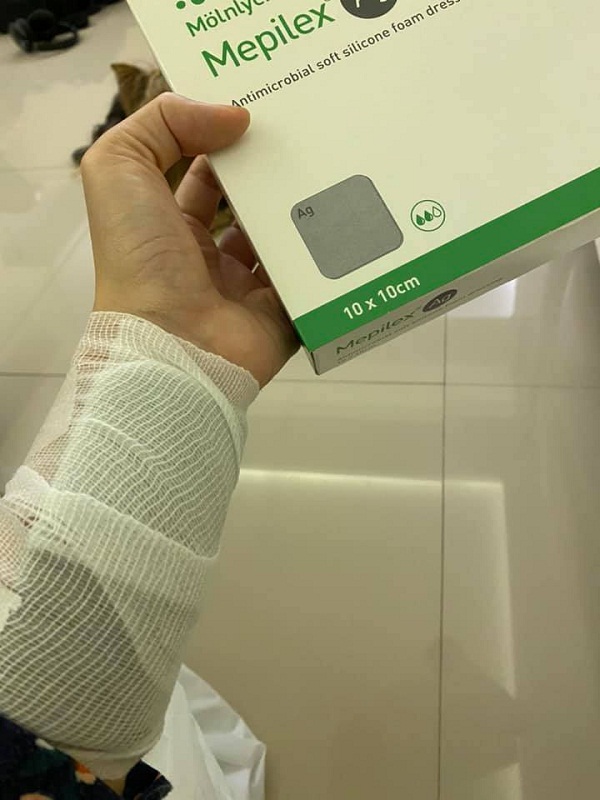  “กระติ๊บ ชวัลกร” หวิดเสียโฉม หลังถูกน้ำมันลวกครั้งที่ 2 (มีคลิป)