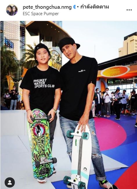 มหัศจรรย์!! ลูกชาย พีท ทองเจือ กลับมาเดินตรงแล้ว 