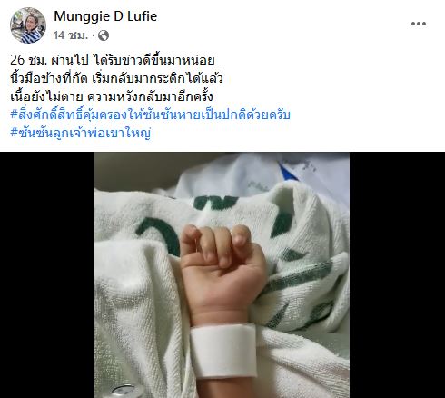 อุทาหรณ์! หนูน้อยถูก งูเห่า กัดอาการโคม่า ผ่านไป 26 ชม.นิ้วเริ่มกระดิกได้