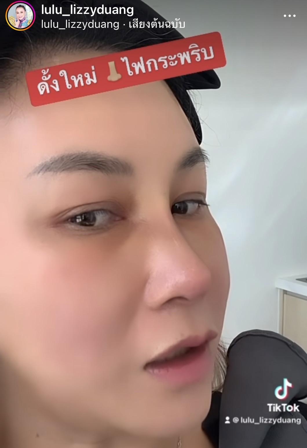 ลูลู่  อวดจมูกใหม่ สวยสมใจ!! หลังขึ้นเขียงทำศัลยกรรมครั้งแรก!! 