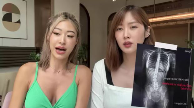 ยิปซี แชร์ประสบการณ์ออกกำลังกายหนัก จนกระดูกสันหลังคด!! 