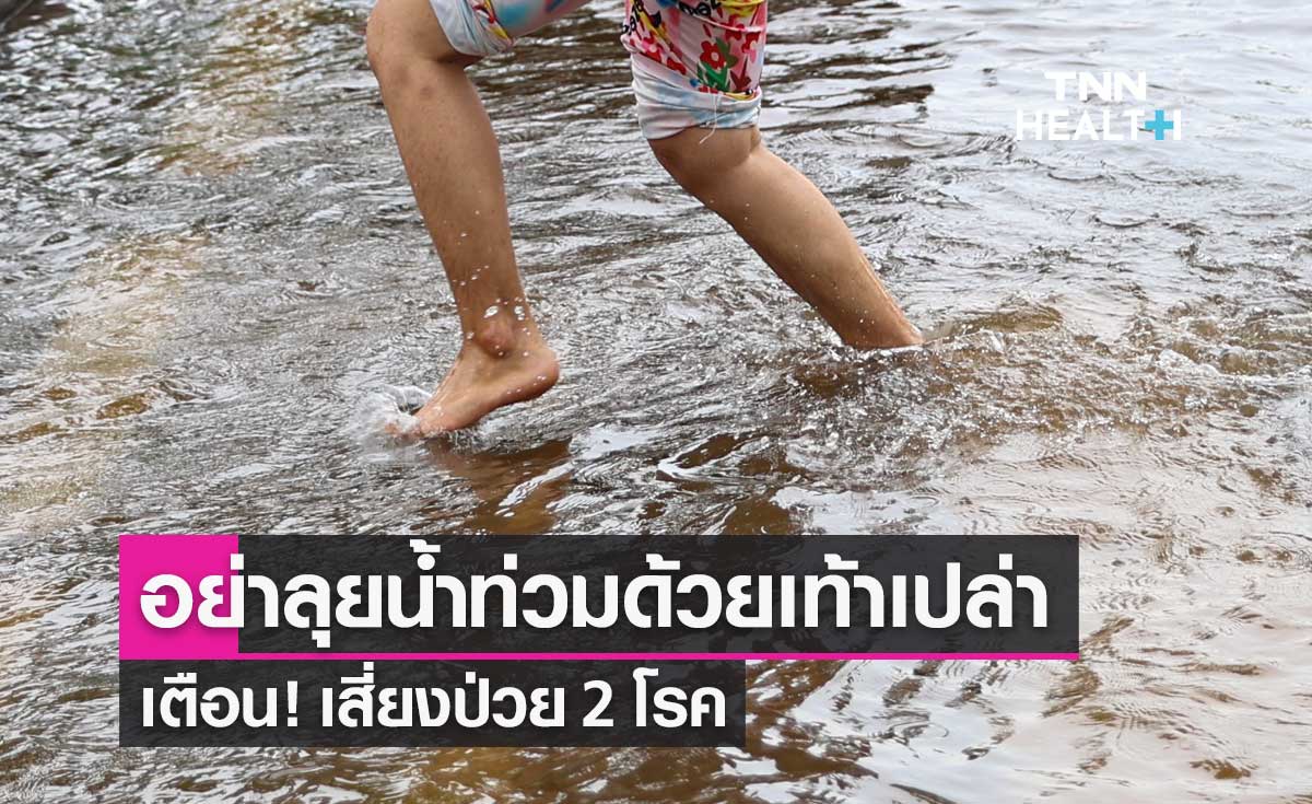 น้ำท่วม น้ำขัง อย่าลุยด้วยเท้าเปล่า แพทย์เตือนเสี่ยงป่วย 2 โรค