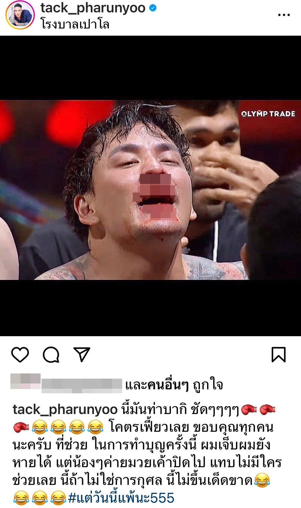 “แทค ภรัณยู” จมูกหัก! หลังถูก “เนท My Mate Nate” สวนหมัดเข้าเต็มหน้า “แทค ภรัณยู” จมูกหัก! หลังถูก “เนท My Mate Nate” สวนหมัดเข้าเต็มหน้า