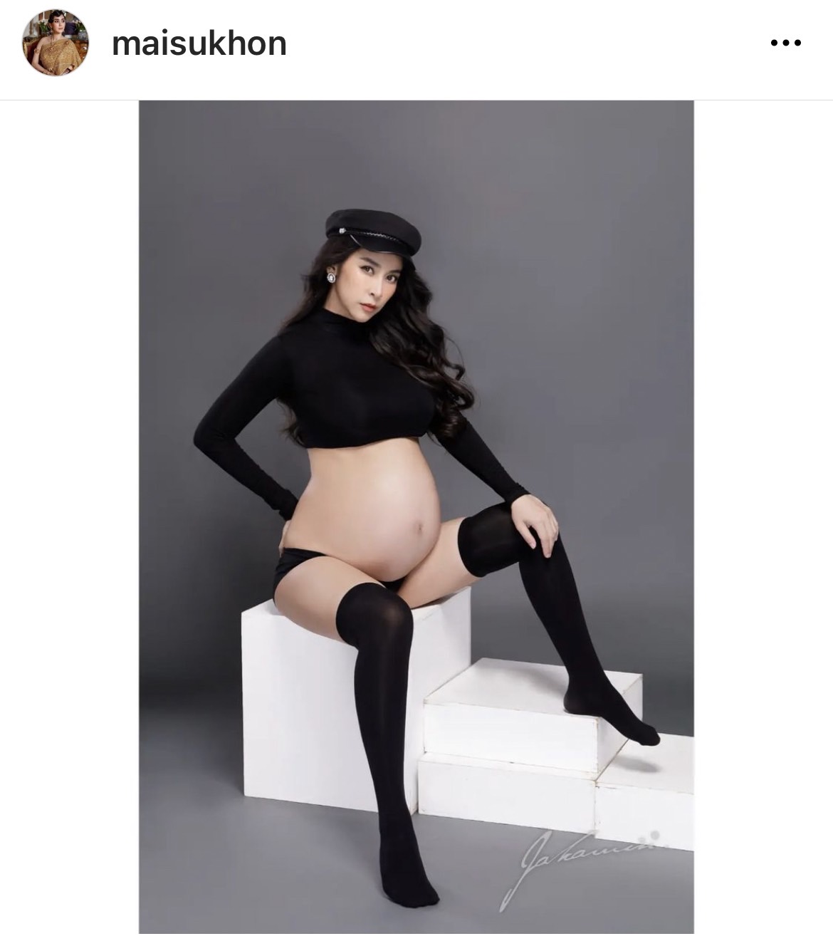 ดีเจต้น เผยลูกสาว น้องชีต้าร์ มีภาวะหัวใจเต้นผิดจังหวะ ดีเจต้น เผยลูกสาว น้องชีต้าร์ มีภาวะหัวใจเต้นผิดจังหวะ