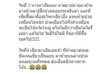 ปอย ปวีณา โพสต์ตาเขียวช้ำ เป็นอุทาหรณ์จากการเล่นสเก็ตบอร์ด 
