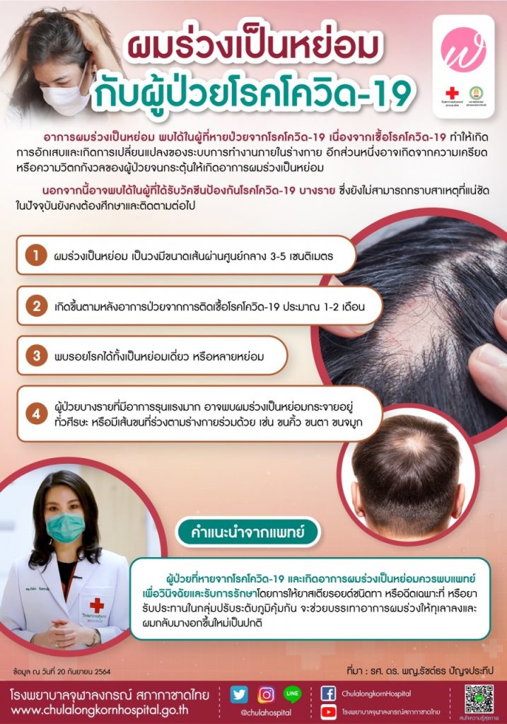 อาการ'ผมร่วง'เป็นหย่อมพบได้ในผู้ป่วยที่หายจากโควิด เกิดจากสาเหตุอะไรเช็กที่นี่ อาการ'ผมร่วง'เป็นหย่อมพบได้ในผู้ป่วยที่หายจากโควิด เกิดจากสาเหตุอะไรเช็กที่นี่