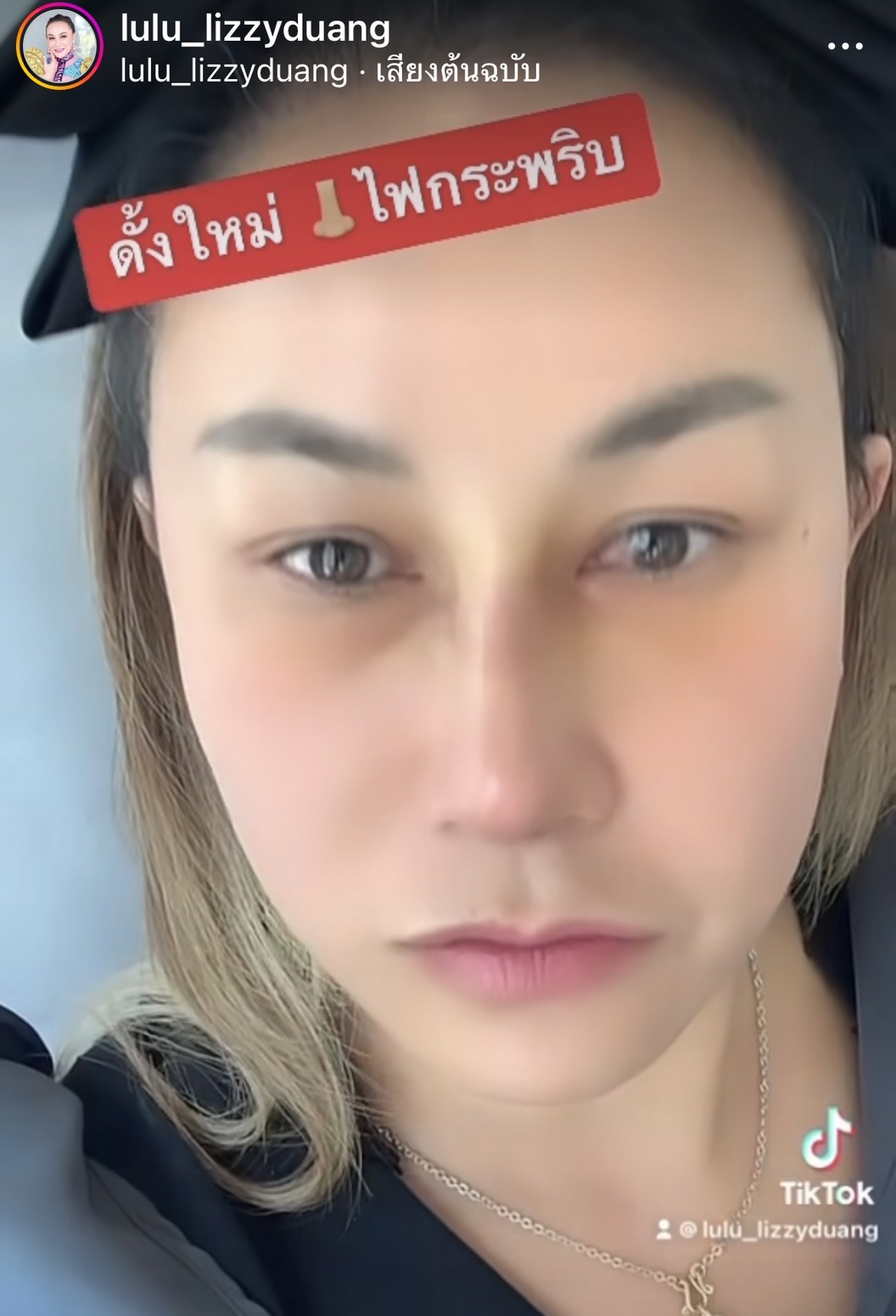 ลูลู่  อวดจมูกใหม่ สวยสมใจ!! หลังขึ้นเขียงทำศัลยกรรมครั้งแรก!! 
