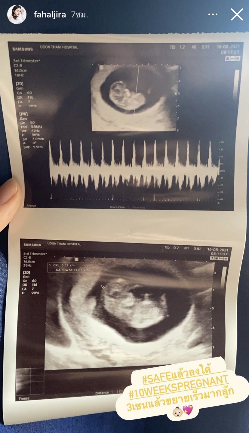 เตรียมเป็นคุณแม่มือใหม่ นักแสดงสาว ฟ้าใส อรจิรา ภรรยาผู้ว่าฯ อุดรธานี ประกาศท้องแล้วจ้า เตรียมเป็นคุณแม่มือใหม่ นักแสดงสาว ฟ้าใส อรจิรา ภรรยาผู้ว่าฯ อุดรธานี ประกาศท้องแล้วจ้า