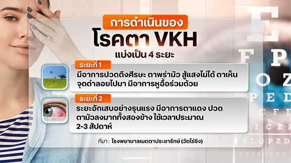 อันตรายโรคตา VKH รักษาที่ถูกวิธี เสี่ยงตาบอดถาวร อันตรายโรคตา VKH รักษาที่ถูกวิธี เสี่ยงตาบอดถาวร