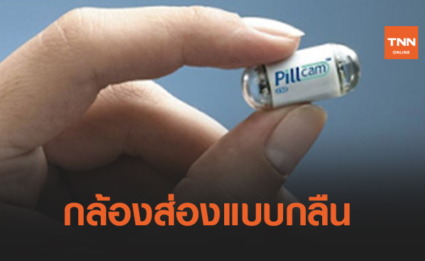‘PillCam’ ตรวจมะเร็งลำไส้แบบใหม่ด้วยกล้องส่องแบบกลืน