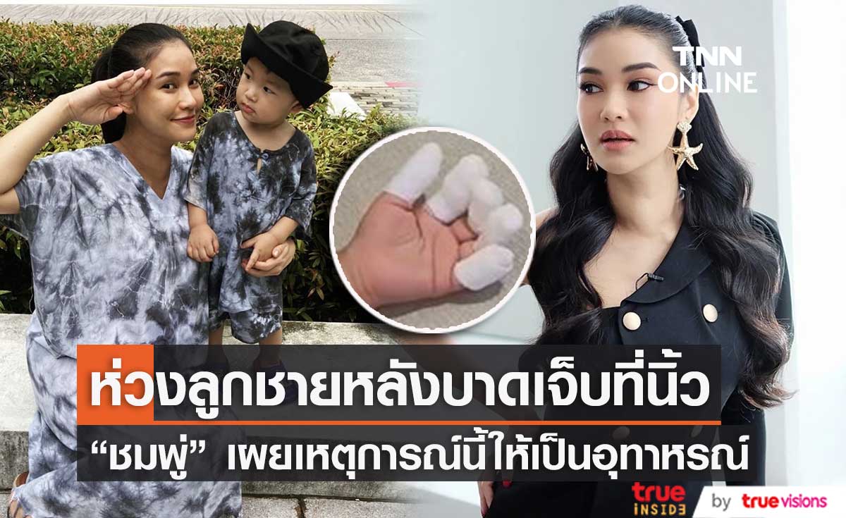 "ชมพู่ ธัณย์สิตา" เผยระวังมากขึ้นหลังลูกชายบาดเจ็บที่นิ้วมือ