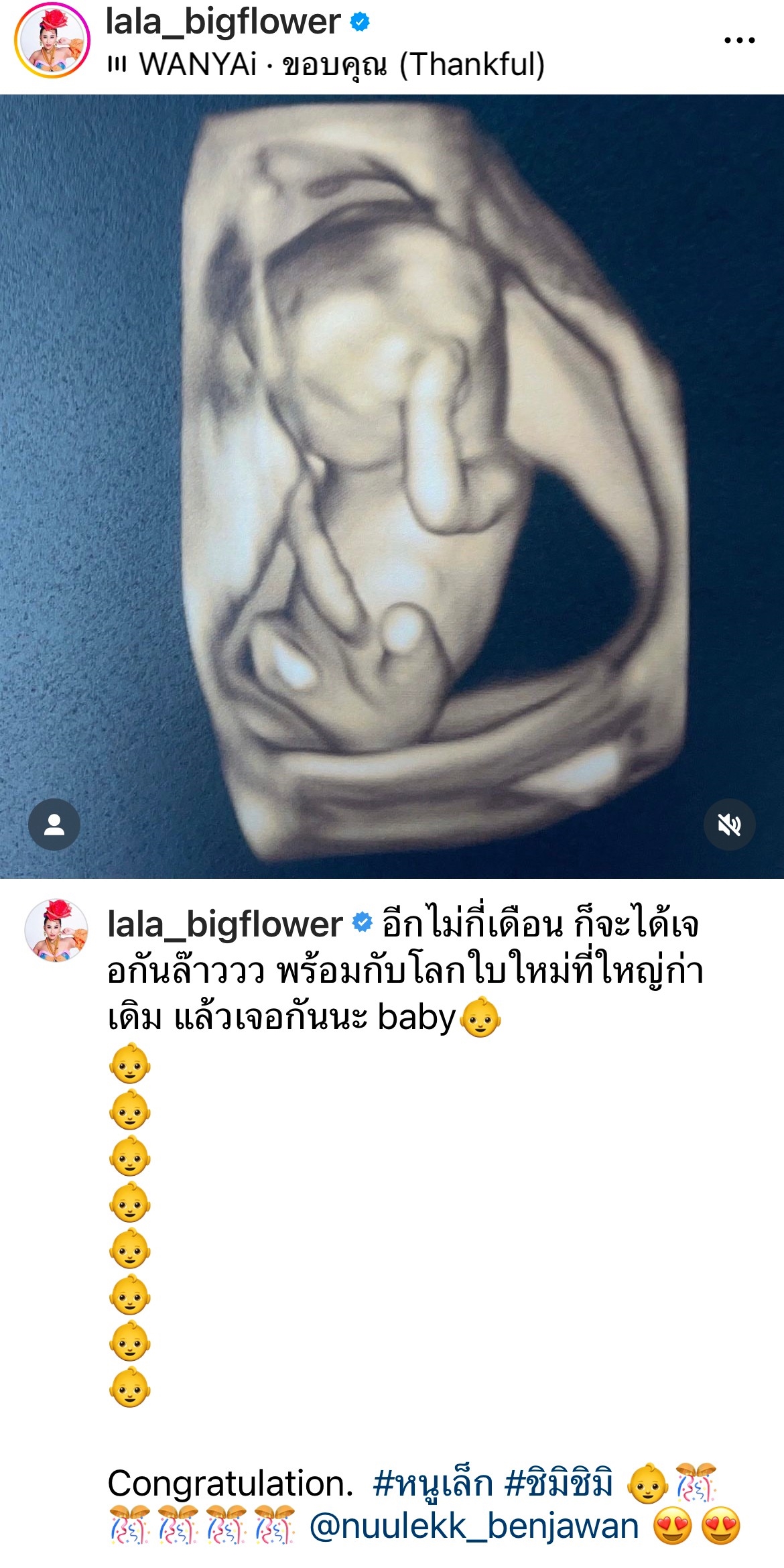 ลาล่า ประกาศข่าวดี หนูเล็ก บลูเบอร์รี่ พร้อมโชว์ภาพอัลตร้าซาวด์ ลาล่า ประกาศข่าวดี หนูเล็ก บลูเบอร์รี่ พร้อมโชว์ภาพอัลตร้าซาวด์