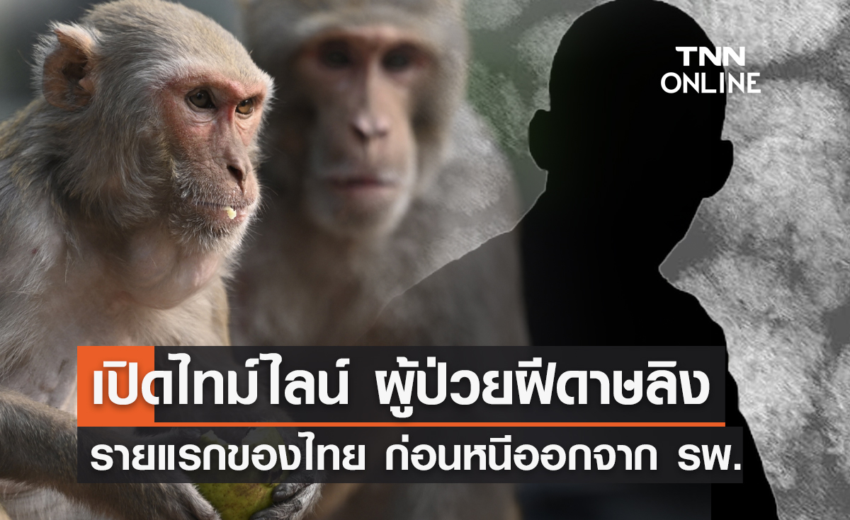 เปิดไทม์ไลน์ ผู้ป่วย ฝีดาษลิง รายแรกของไทย ก่อนหนีออกจาก รพ.