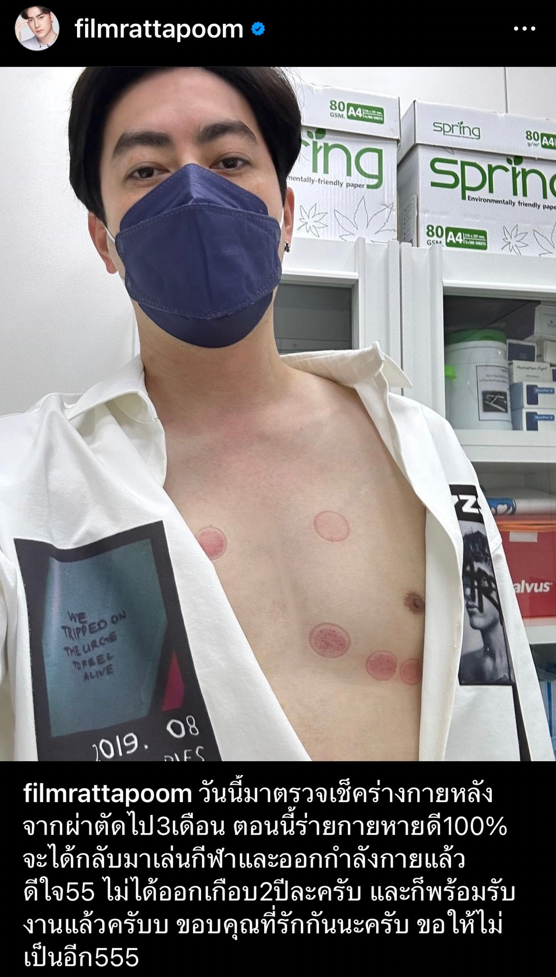 ฟิล์ม รัฐภูมิ อัปเดตผลตรวจร่างกาย หลังผ่าตัดลิ้นหัวใจรั่วครบ 3 เดือน 