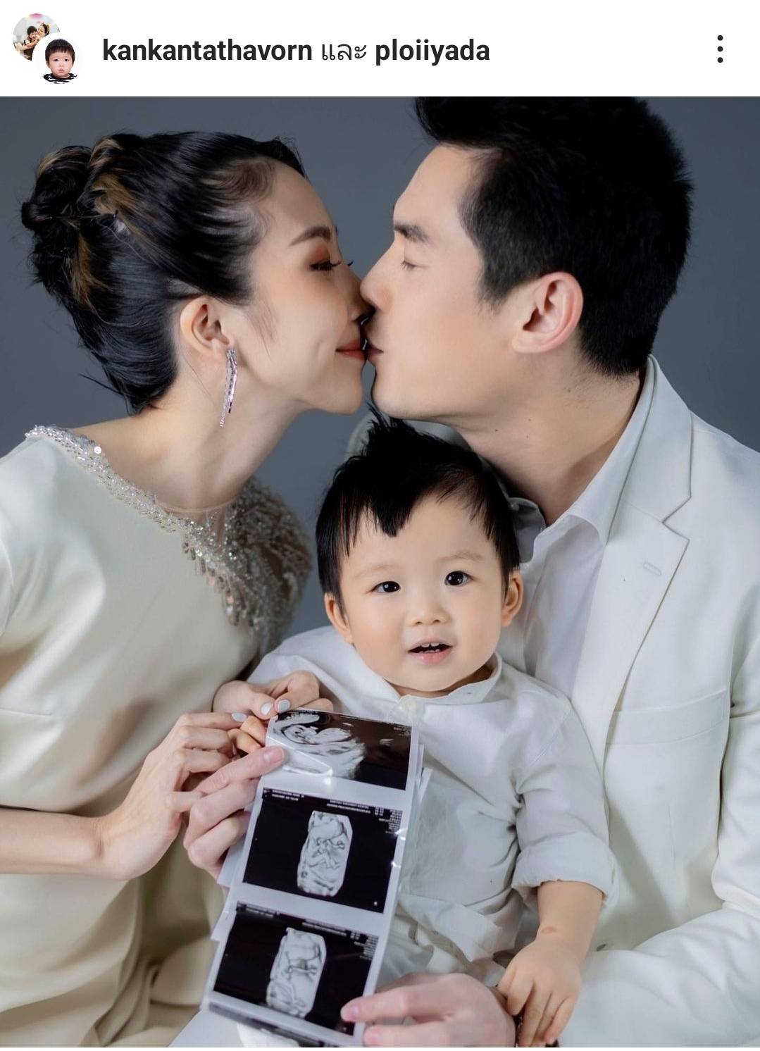 กันต์ กันตถาวร ประกาศข่าวดีภรรยาตั้งท้องลูกคนที่สอง หลัง ปิดเป็นความลับมา3เดือน