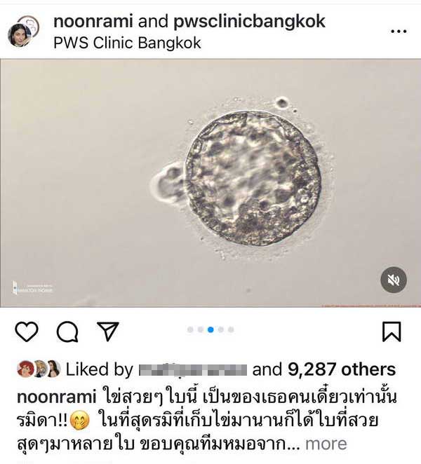 หลุยส์ สก๊อต พา นุ่น รมิดา เก็บไข่ เดินหน้าแพลนมีทายาท หลังใช้ชีวิตคู่มา12ปี หลุยส์ สก๊อต พา นุ่น รมิดา เก็บไข่ เดินหน้าแพลนมีทายาท หลังใช้ชีวิตคู่มา12ปี