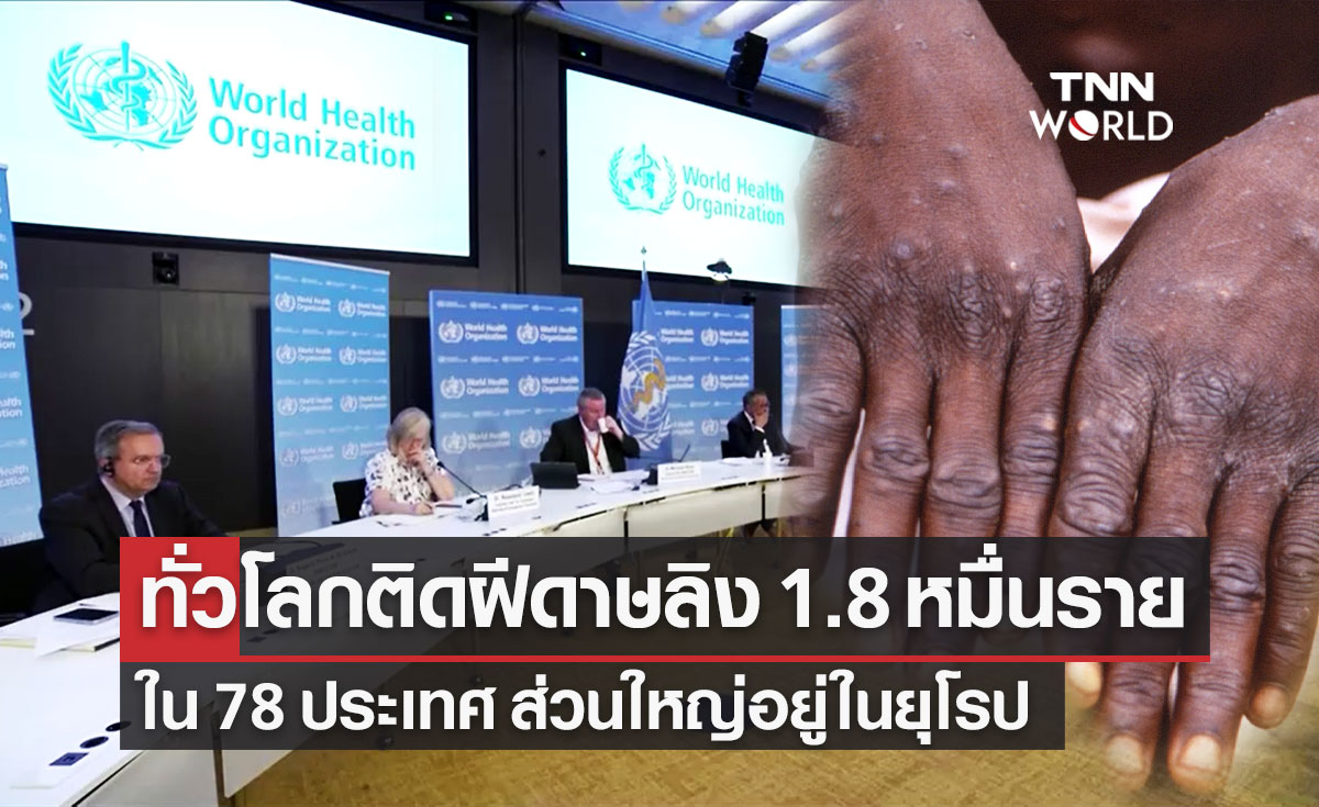 "ฝีดาษลิง" ทั่วโลกติดเชื้อแล้ว 1.8 หมื่นราย ใน 78 ประเทศ