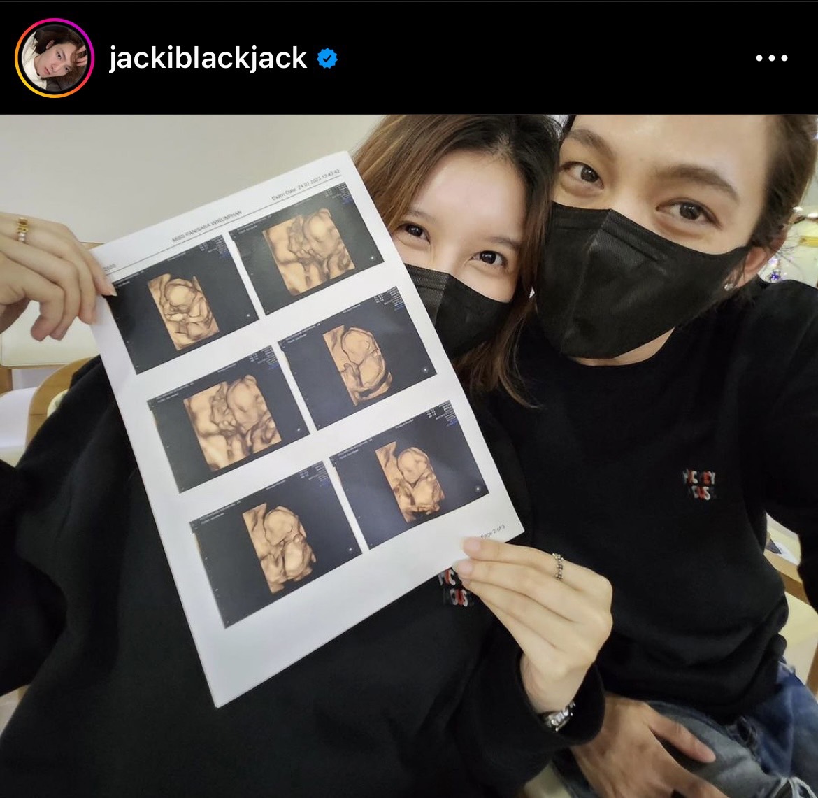 กำลังจะเป็นคุณพ่อ แจ็คแบล็คแจ็ค ประกาศข่าวดี แฟนสาวตั้งท้อง 5 เดือน 
