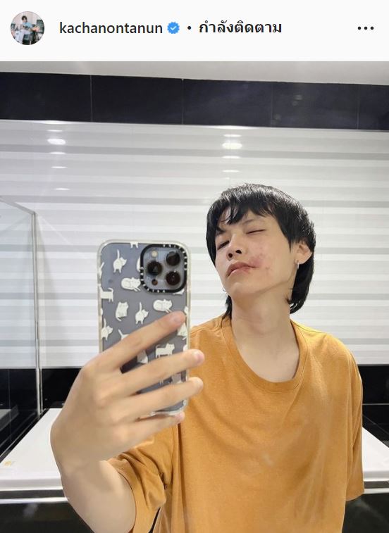 00