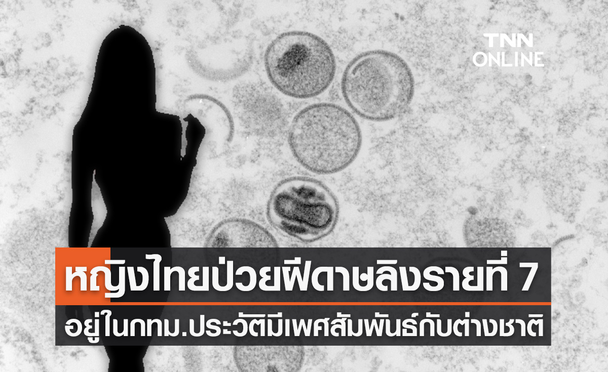 "ฝีดาษลิง" รายที่ 7 เป็นหญิงไทย อายุ 37 ปี อยู่ในกทม.ใกล้ชิดชายต่างชาติผิวสี
