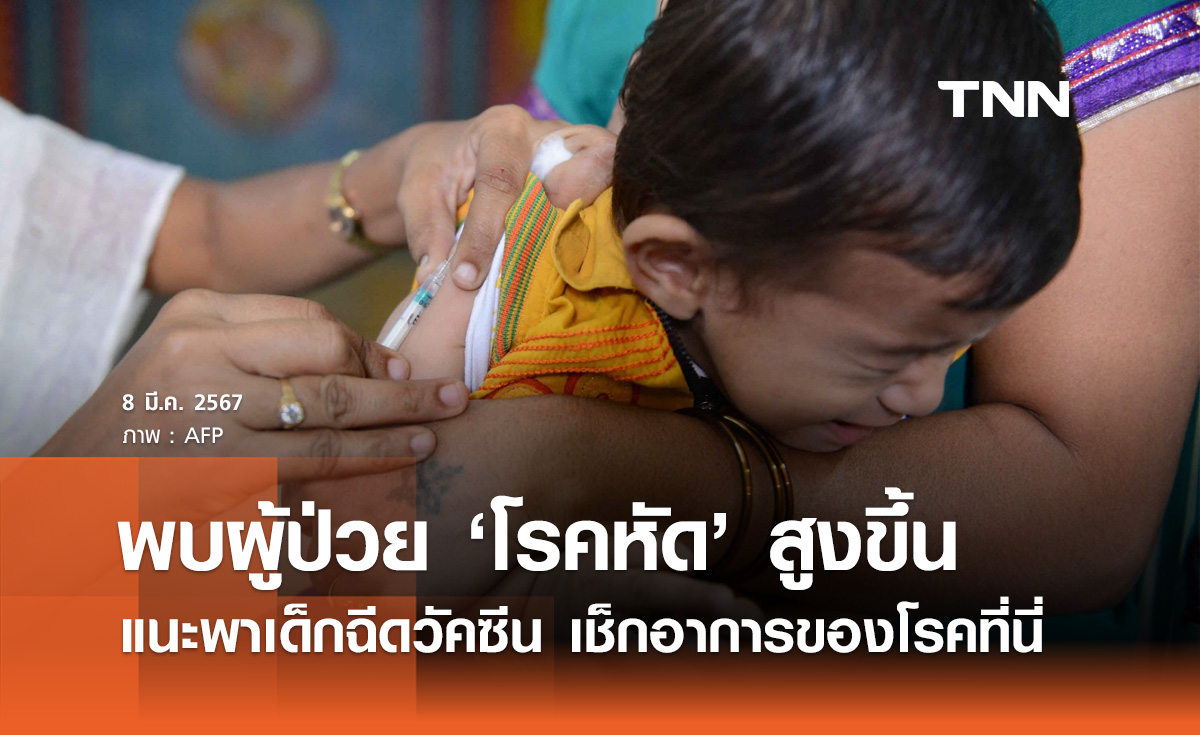 กรมควบคุมโรค เผยปีนี้พบผู้ป่วย "โรคหัด" สูงขึ้น แนะพาเด็กเล็กฉีดวัคซีน