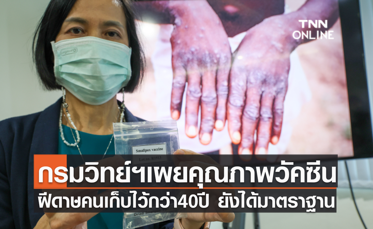 กรมวิทย์ฯเผยคุณภาพวัคซีนฝีดาษคนเก็บไว้กว่า 40 ปี ยังได้มาตราฐาน