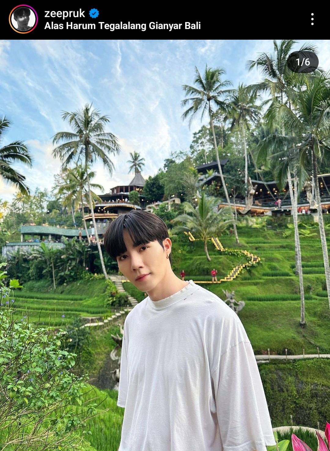 ตัดไหมแล้ว ซี พฤกษ์ อัปเดตอาการหลังประสบอุบัติเหตุจนต้องเย็บถึง 8 เข็ม