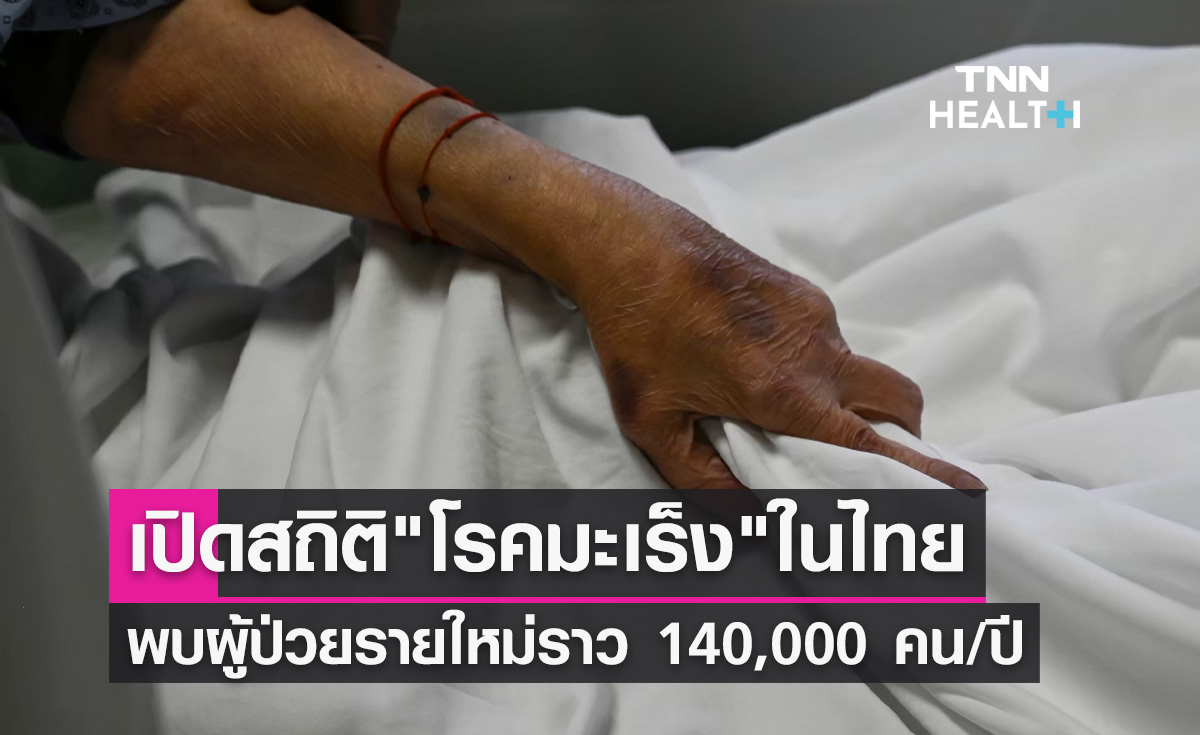 เปิดสถิติ โรคมะเร็ง ในไทย พบผู้ป่วยรายใหม่ประมาณ 140,000 คน/ปี