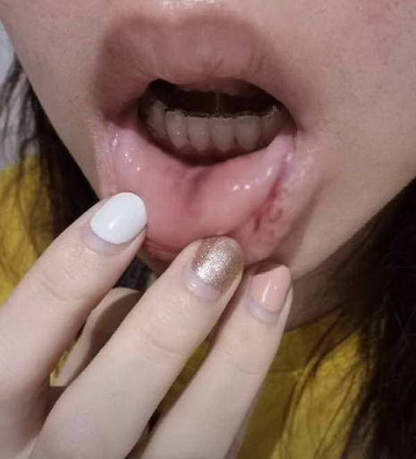 ช็อก! เชอรีน น้องสาว นิชคุณ เปิดบาดแผลถูกอดีตสามีทำร้าย เข้าแจ้งความหวั่นความปลอดภัย ช็อก! เชอรีน น้องสาว นิชคุณ เปิดบาดแผลถูกอดีตสามีทำร้าย เข้าแจ้งความหวั่นความปลอดภัย