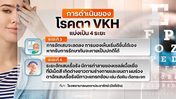 อันตรายโรคตา VKH รักษาที่ถูกวิธี เสี่ยงตาบอดถาวร อันตรายโรคตา VKH รักษาที่ถูกวิธี เสี่ยงตาบอดถาวร