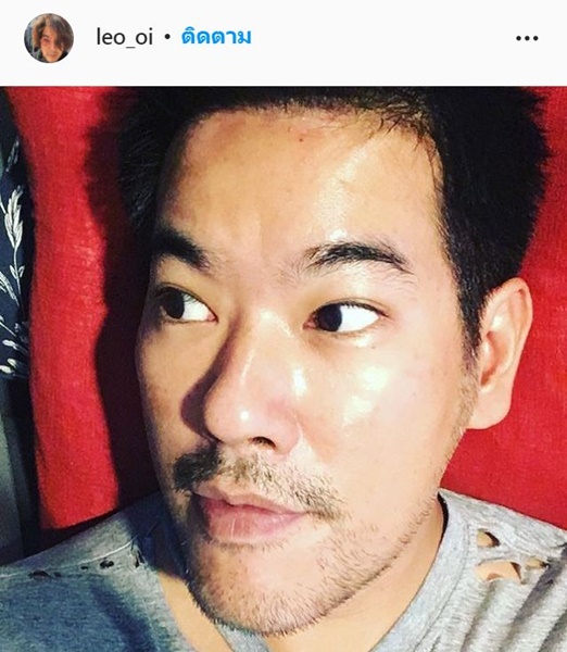 “ลีโอ พุฒ” อัดคลิปอัปเดตการผ่าตัดรักษาโรคเส้นเลือดหัวใจตีบ