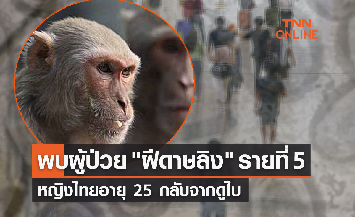 ด่วน! สธ.พบผู้ป่วย ฝีดาษลิง รายที่ 5 หญิงไทยอายุ 25 กลับจากนครดูไบ