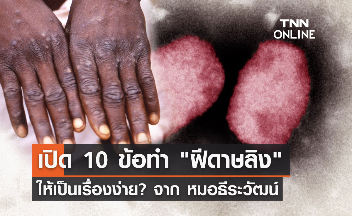"ฝีดาษลิง" หมอธีระวัฒน์ เผย 10 ข้อทำโรคนี้ให้เป็นเรื่องง่าย?